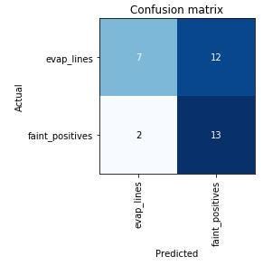 Using AI to Classify Pregnancy Test Results